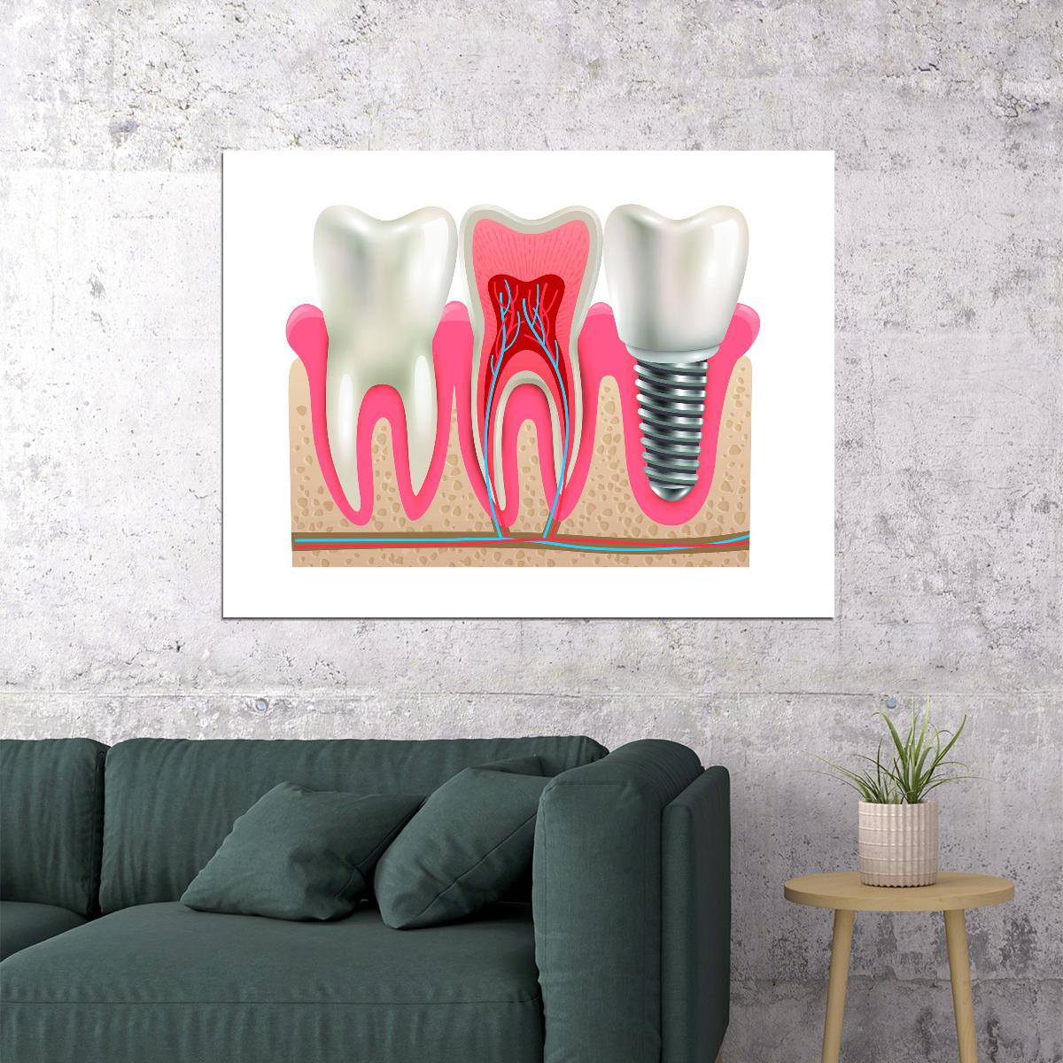 Dental Anatomy Art Poster Educational Tooth Structure Wall Decor Modern Artistic Design Medical Wall Print