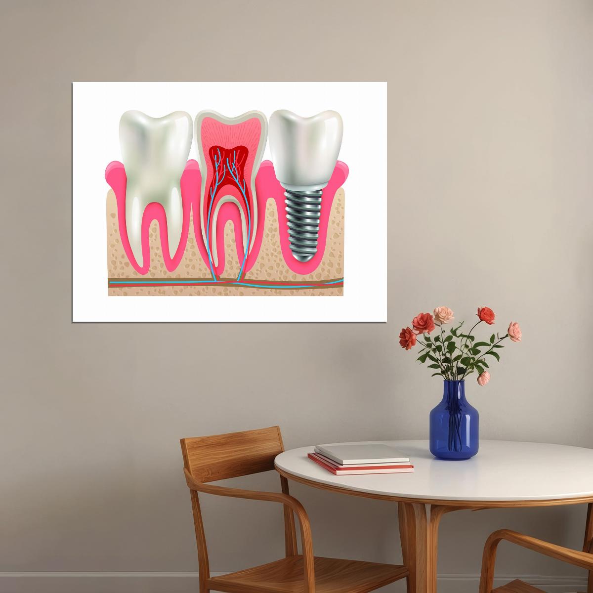 Dental Anatomy Art Poster Educational Tooth Structure Wall Decor Modern Artistic Design Medical Wall Print