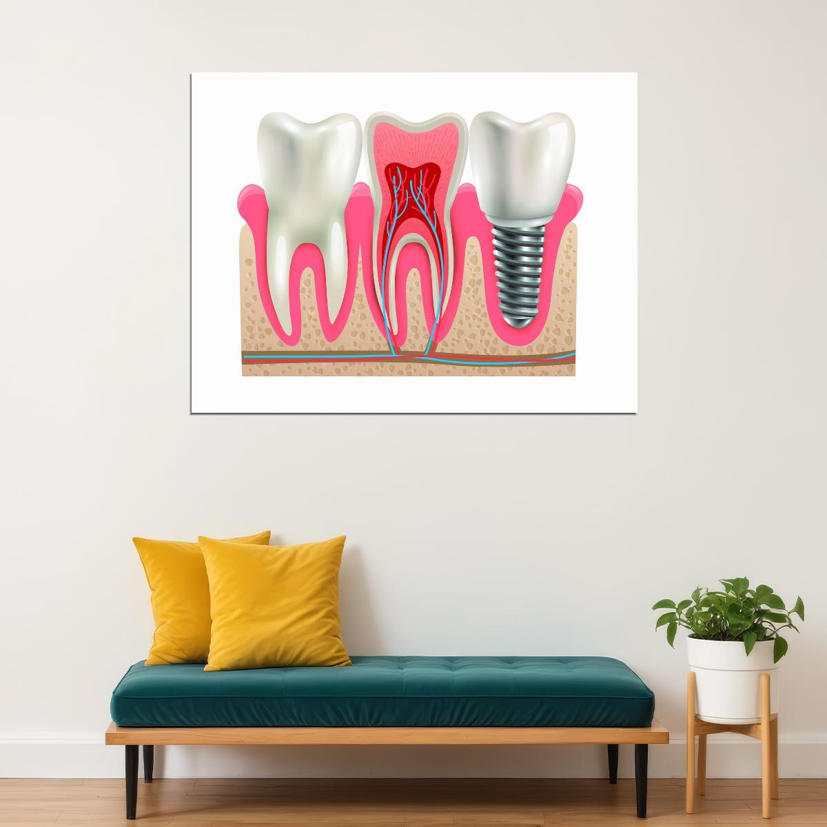 Dental Anatomy Art Poster Educational Tooth Structure Wall Decor Modern Artistic Design Medical Wall Print